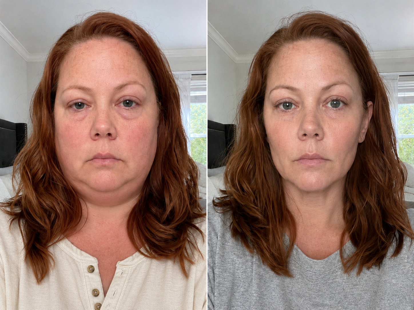 Before and after - face and jawline