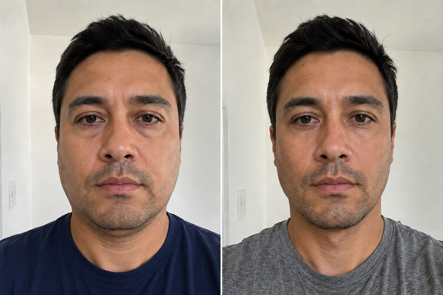 Before and after - face depuff