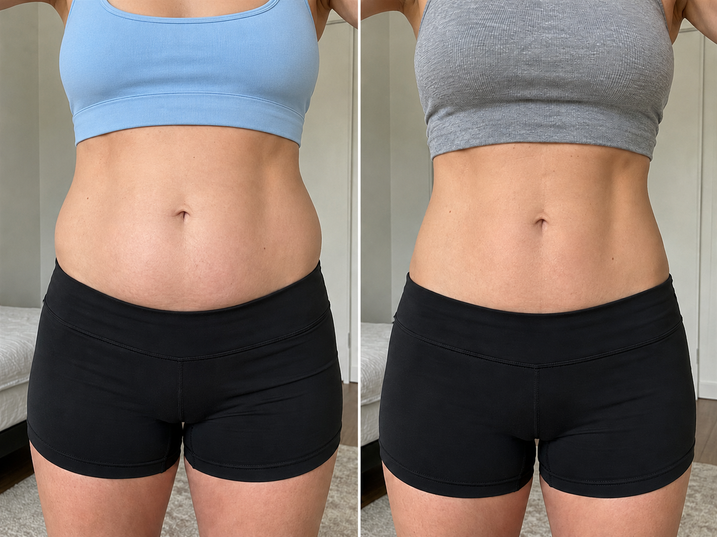 Before and after - belly bloat